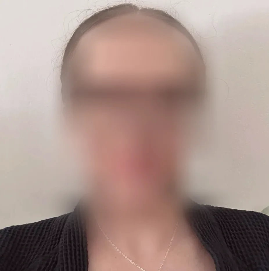 Rosa, 28